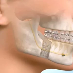 Ağız Diş ve Çene Cerrahisi