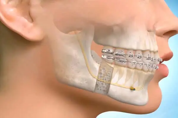 agiz-ve-cene-cerrahisi-adana-dental Ağız Diş ve Çene Cerrahisi