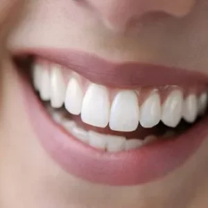 Restoratif Diş Hekimliği